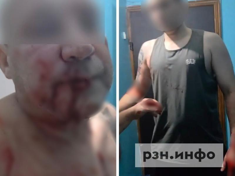 Сосед избил рязанца за запах сигарет, его семья опасается, что виновника не посадят